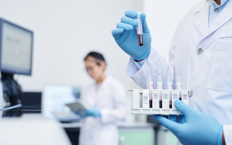 Anti hbs ne kadar olmalı