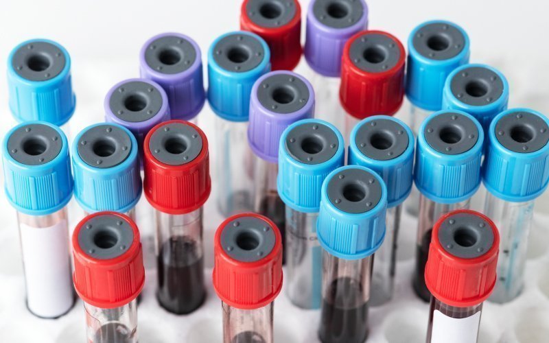 Anti hbs negatif ne anlama gelir