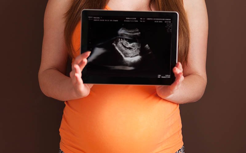 Amniyon sıvı indeksi